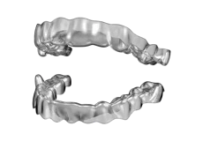 Appareil transparent pour soulager le syndrome d'apnée obstructive du sommeil (Osas)