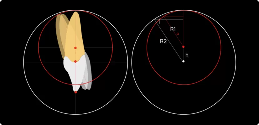 Rendre possible le mouvement précis des dents