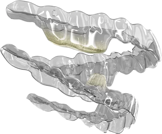 Qu'est-ce que Smartee GS?