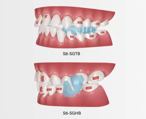 Dispositif de repositionnement mandibulaire pour l'avancement mandibulaire