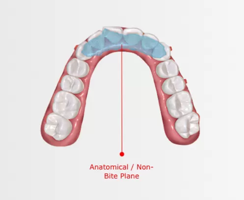 Dispositif de repositionnement mandibulaire avec avion de bitume
