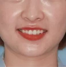 Photos faciales avant le traitement