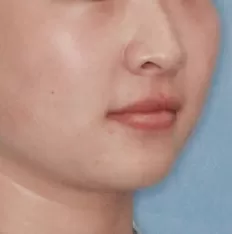 Photos faciales avant le traitement