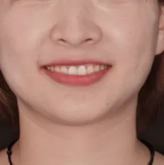 Photos faciales avant le traitement