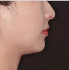 Photos faciales avant le traitement