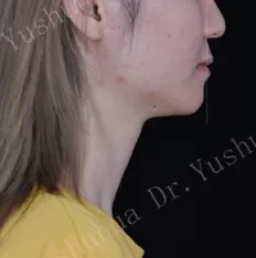 Photos faciales avant le traitement