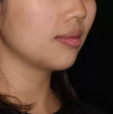 Photos faciales avant le traitement