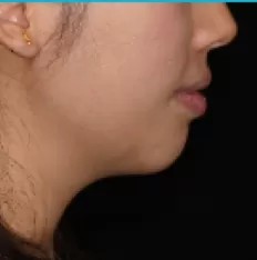 Photos faciales avant le traitement