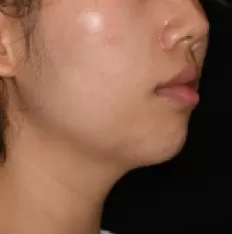 Photos faciales avant le traitement