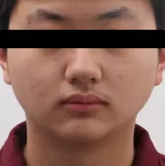 Photos faciales avant le traitement