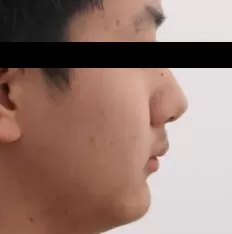 Photos faciales avant le traitement