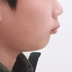 Photos faciales avant le traitement