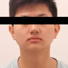 Photos faciales avant le traitement