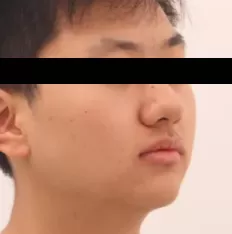 Photos faciales avant le traitement