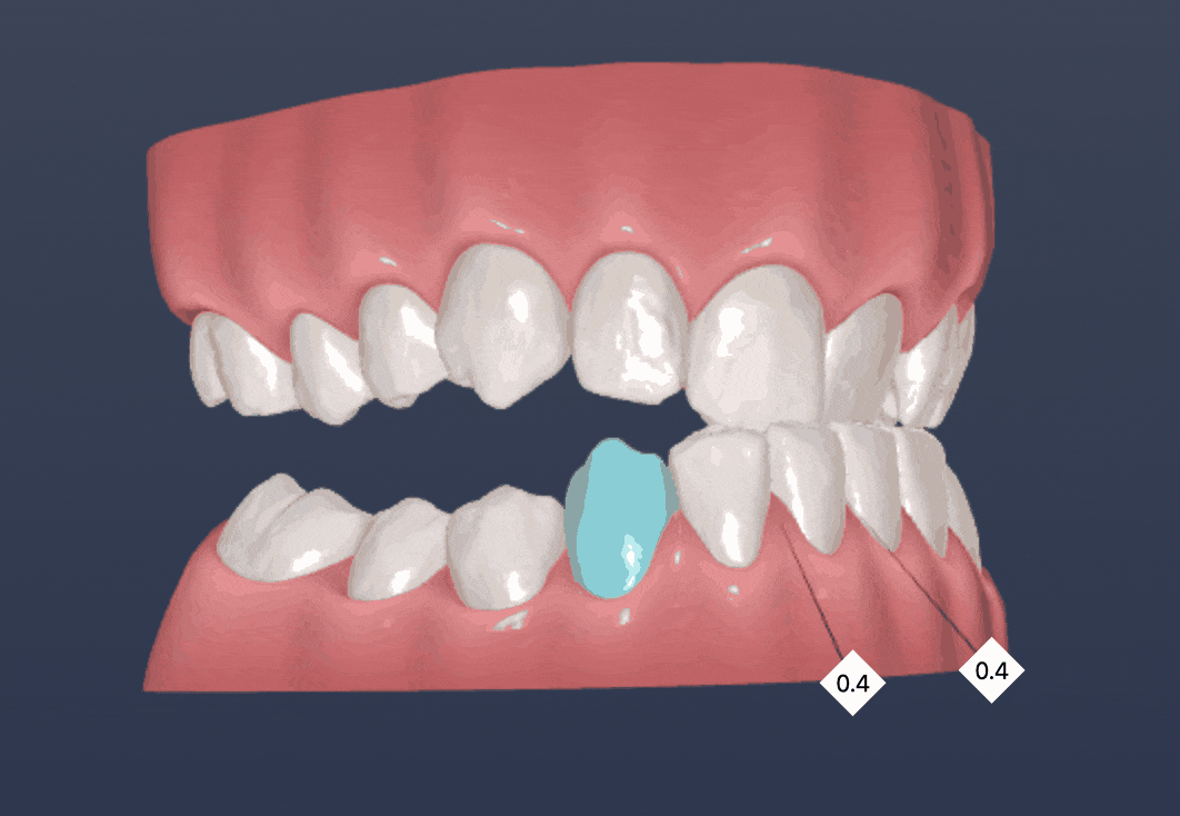 Phase 1 (Orthopédie et Orthodontie)