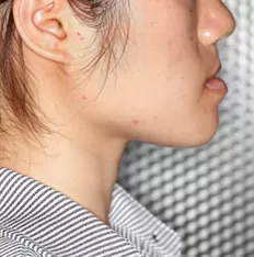 Photos faciales avant le traitement