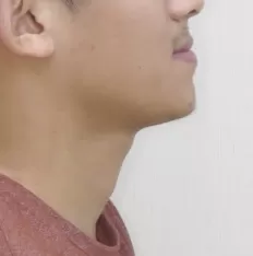 Photos faciales avant le traitement