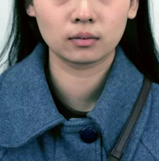 Photos faciales avant le traitement