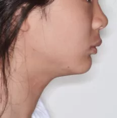 Photos faciales avant le traitement