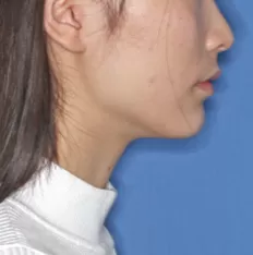 Photos faciales avant le traitement