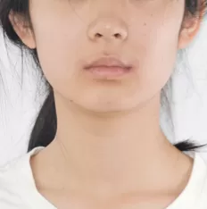 Photos faciales avant le traitement