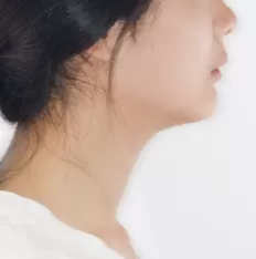 Photos faciales avant le traitement