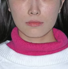 Photos faciales avant le traitement