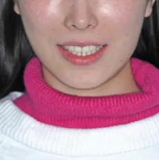 Photos faciales avant le traitement