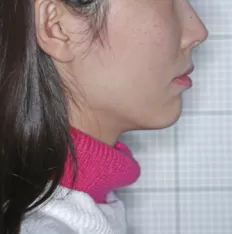 Photos faciales avant le traitement