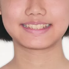 Photos faciales avant le traitement