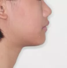 Photos faciales avant le traitement