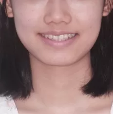 Photos faciales avant le traitement