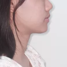 Photos faciales avant le traitement