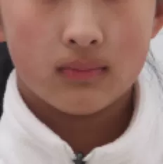 Photos faciales avant le traitement