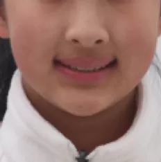 Photos faciales avant le traitement