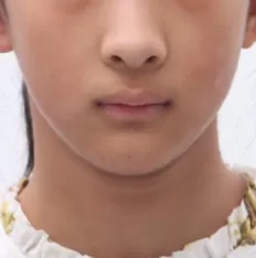 Photos faciales avant le traitement