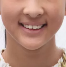 Photos faciales avant le traitement