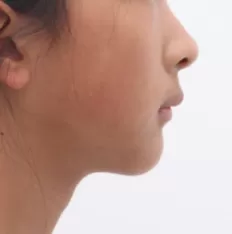 Photos faciales avant le traitement