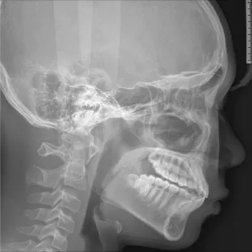 Rayons X avant le traitement