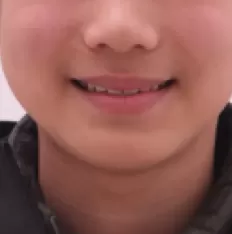 Photos faciales avant le traitement