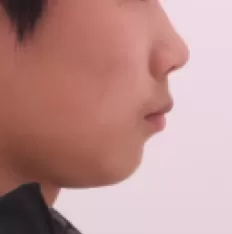 Photos faciales avant le traitement