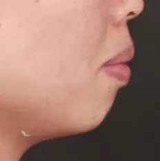 Photos faciales avant le traitement