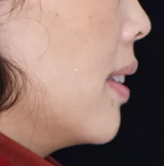 Photos faciales avant le traitement