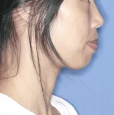 Photos faciales avant le traitement