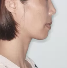 Photos faciales avant le traitement