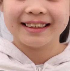 Photos faciales avant le traitement