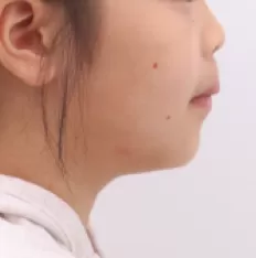 Photos faciales avant le traitement