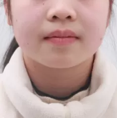 Photos faciales avant le traitement