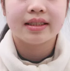 Photos faciales avant le traitement