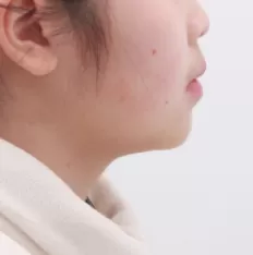 Photos faciales avant le traitement